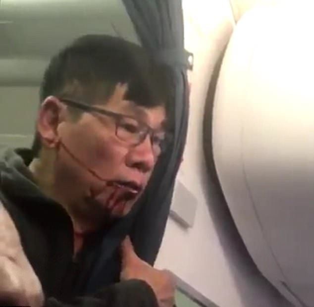 Вижте как влачиха и изхвърлиха насила мъж от самолет на United Airlines (СНИМКИ/ВИДЕО 18+)