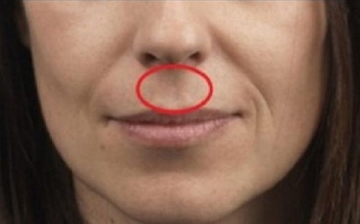 Имате ли това между носа и горната устна? А знаете ли какво означава това? Вижте тук! (СНИМКА)