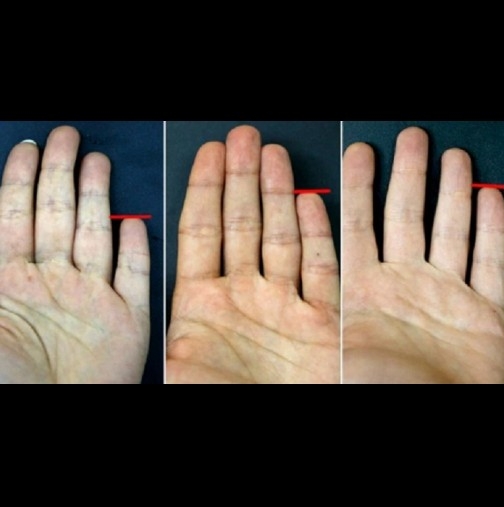 Изненада! Вижте това, което могат да кажат малките пръсти на ръцете ви! 