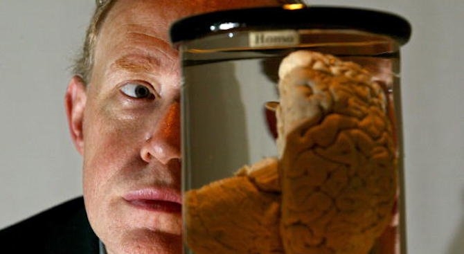Каква е разликата в мозъците на болните от Алцхаймер и тези на нормалните хора?