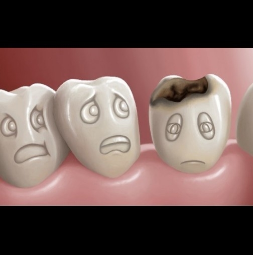 Искате безупречно здрави зъби? Спазвайте тези прости, но много ценни съвети