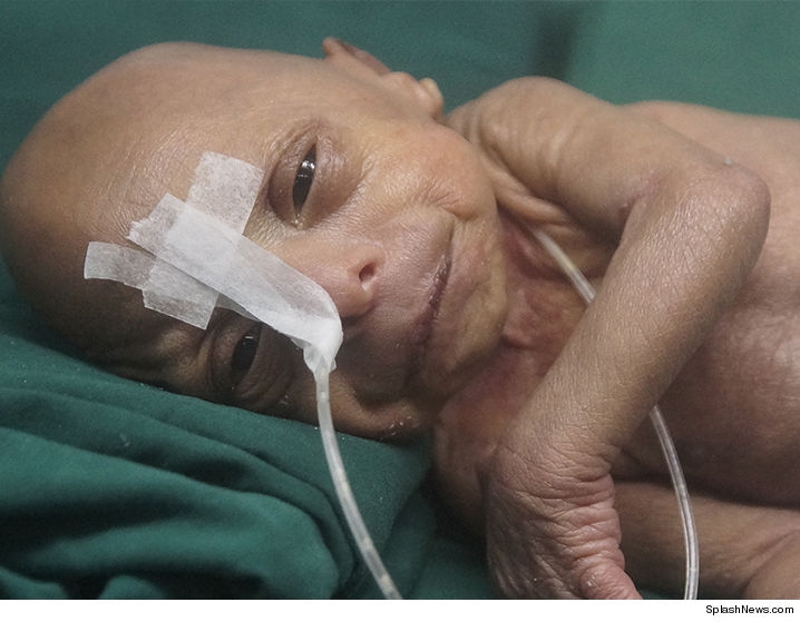 Бебе старец се роди в Бангладеш (СНИМКА)