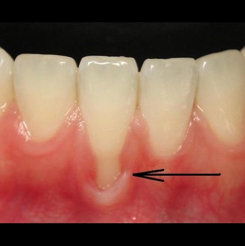 Тези чудотворни методи ще предпазят зъбите и венците ви!