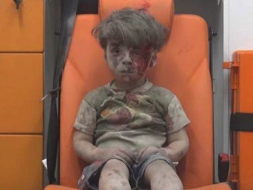 Спомняте ли си момченцето, което стана „символ на страданието в Алепо”? Ето какво се случва с малкия Омран днес (СНИМКИ)