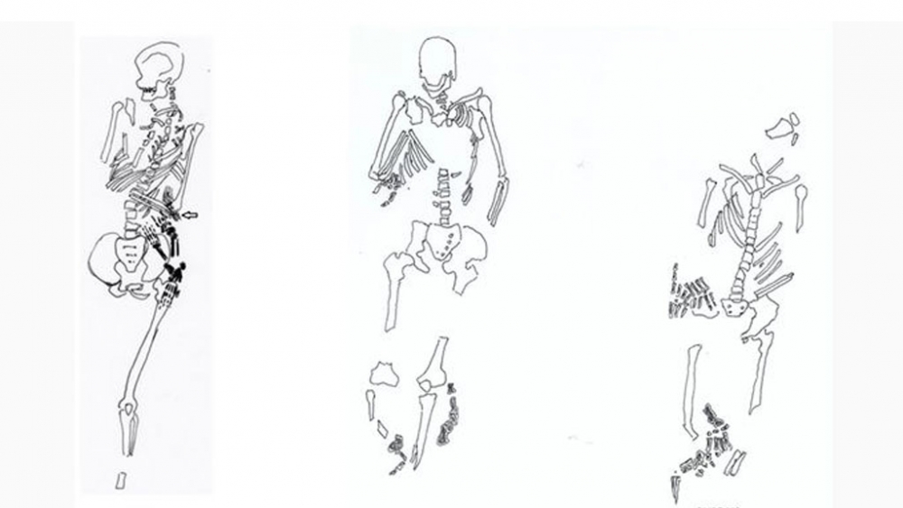 По законите на хан Крум: В Португалия откриха 3 скелета на младежи с отсечени за наказание ръце и крака