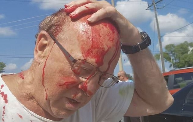 Шокираща агресия: Развилнял се шофьор преби брутално и окървави колоездач (СНИМКИ/ВИДЕО 18+)