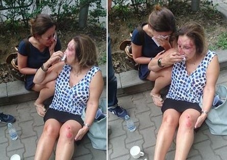МВР с подробности за брутално пребитите жени в Борисовата
