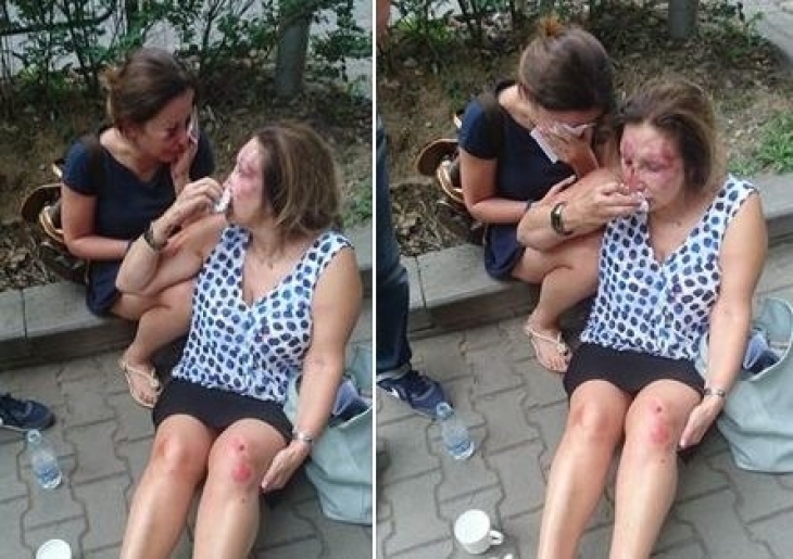 Спипаха ли бабаитите, които пребиха брутално две жени вчера в Борисовата градина?