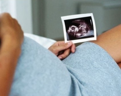 36-г жена разбра, че е бременна, когато взе да ражда 