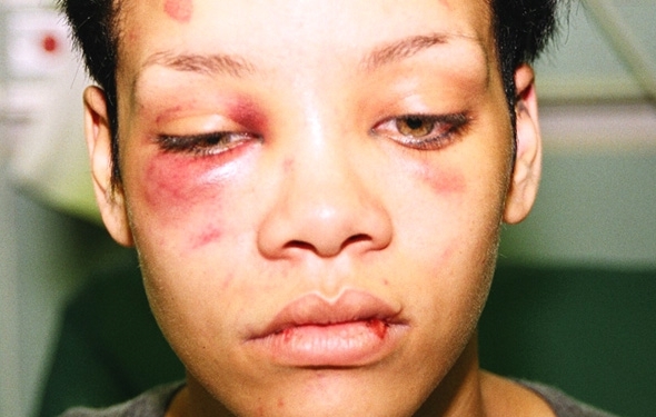 Крис Браун разкри нечувани досега подробности за побоя над Риана: Тя ме плюеше с кръв и ме удряше злобно!