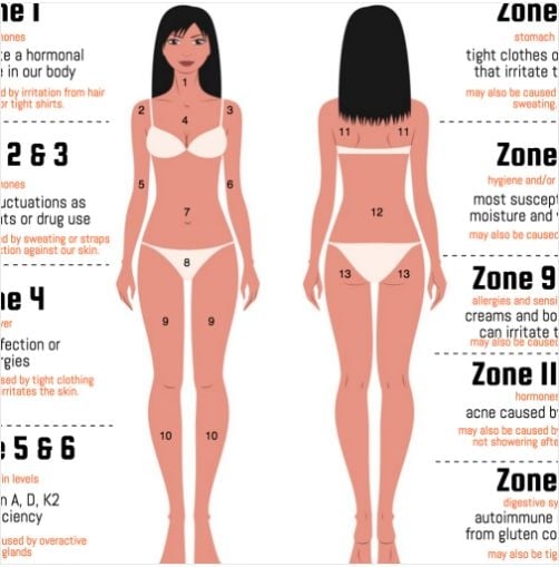 Ето какво ви разкриват пъпките на различните места по тялото ви