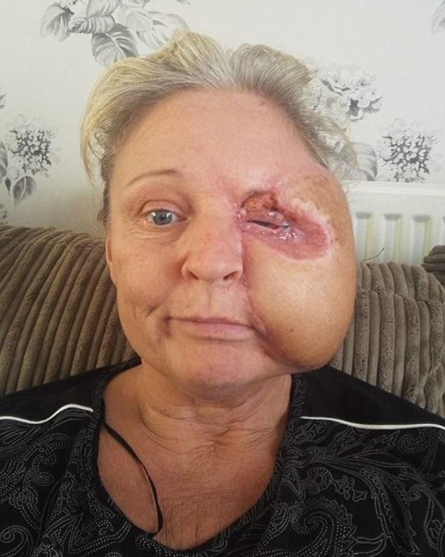 Майка се удари в печка и изгуби половината от лицето си заради нещо страшно (СНИМКИ)