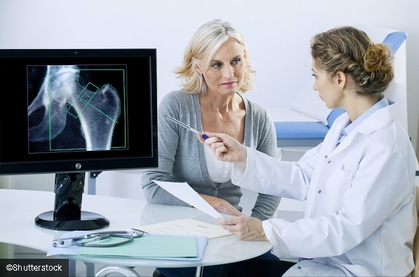 Русенка си направи изследвания на костната плътност и попита специалист: Какво е най-доброто лечение на остеопороза?