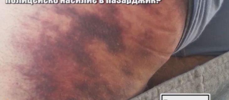 Очевидци: Полицаи в Пазарджик се редуваха да бият като куче Светослав в районното, синините му са страшни (ВИДЕО)