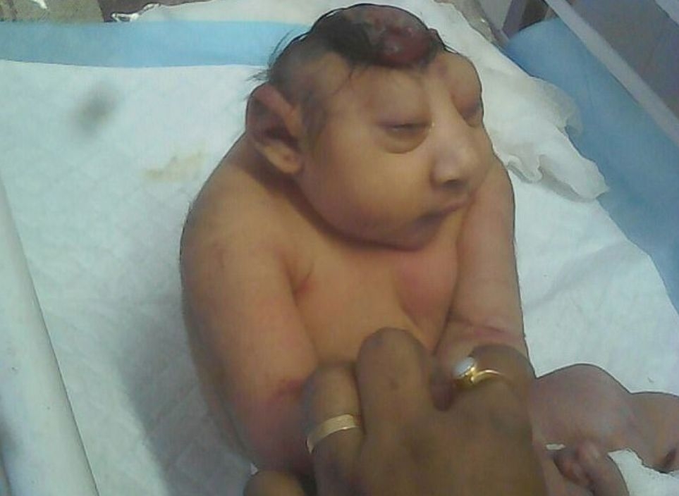 Лекарите са безсилни: Не можем да направим нищо, за да спасим живота на това бебе с рядка патология (СНИМКИ 18+)