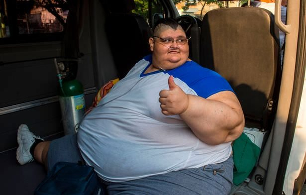 Най-дебелият човек в света свали 175 килограма, за да може лекарите да достигнат до стомаха му 