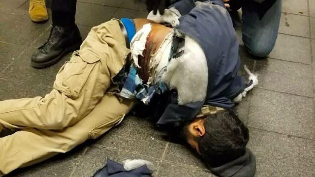 Първа СНИМКА (18+) на атентатора от Манхатън, бомбата е откъснала едната му ръка! 