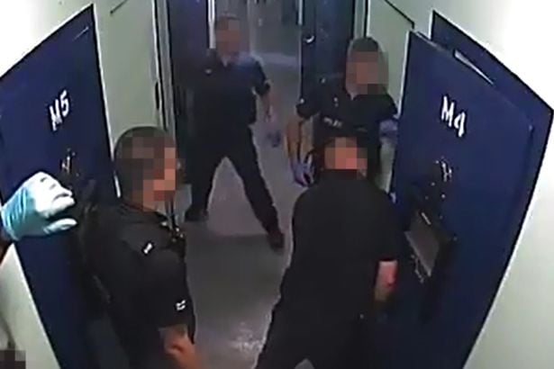 Полицаи случайно отрязаха пръстите на арестант (СНИМКИ/ВИДЕО 18+)