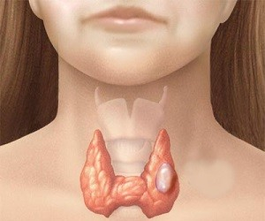 7 неща, които съсипват здравето на щитовидната жлеза