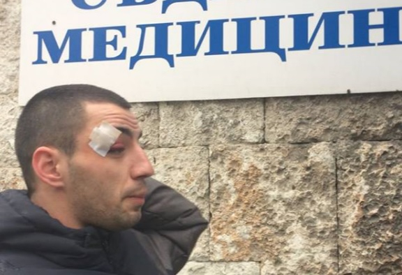 Нов брутален случай на полицейско насилие в Добрич! Ченгета смляха от бой младеж, дават му да пие вода от спринцовка