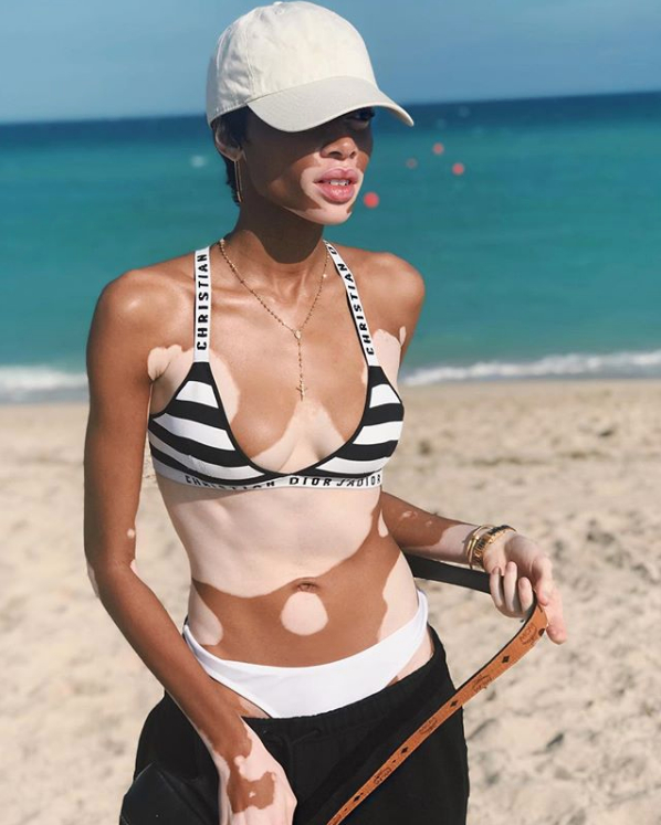 Най-известната петниста моделка възбуди Инстаграм със свои СНИМКИ по бански 