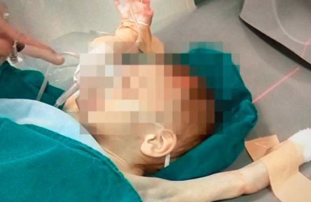 Най-сетне добра новина за 3-годишното близначе, което изпадна в кома след инцидент в дома си 