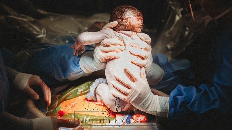 Американка извади собственото си бебе след цезарово сечение (УНИКАЛНИ СНИМКИ)
