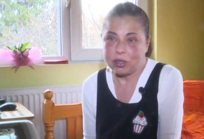 Здравни емигранти: След Адриан и Елисавета се бори за живота си, бягайки от България (ВИДЕО)