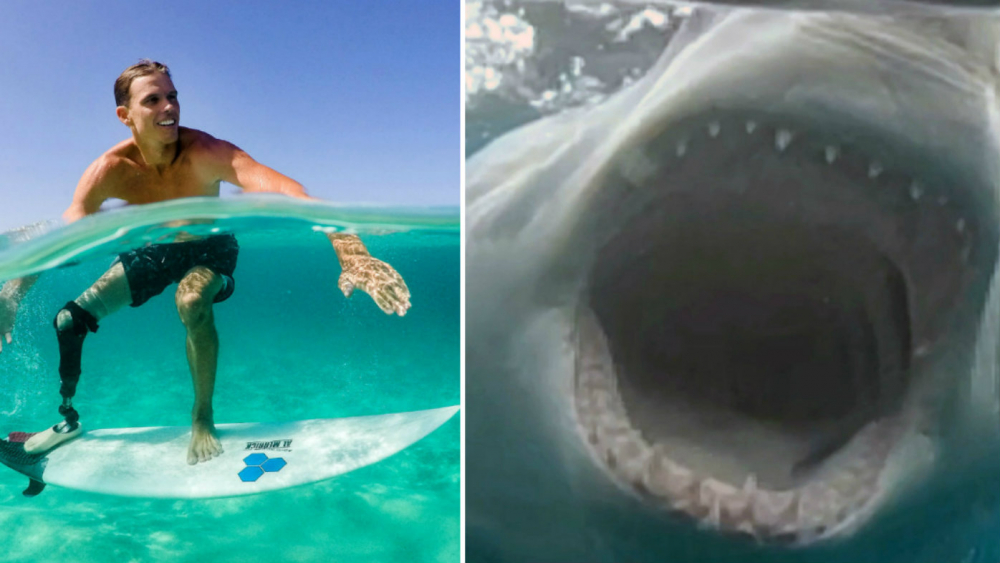 Сърфист с отхапан от акула крак, запечата на ВИДЕО челюстите на морското чудовище, докато то плувало само на сантиметри от него (СНИМКИ)