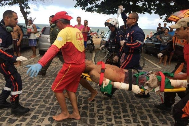 Кръвожадна акула нападна турист, наложи се да му ампутират крака (СНИМКИ/ВИДЕО 18+)