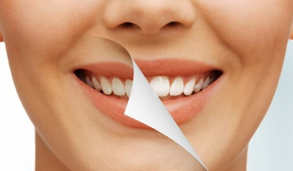 Бърз и лесен домашен метод за избелване на зъбите смая стоматолозите