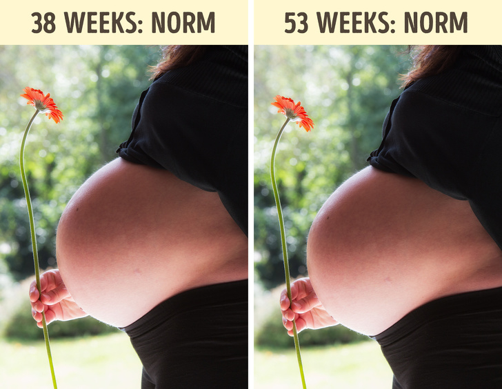 9 факта за бременността, които шокират и лекарите СНИМКИ