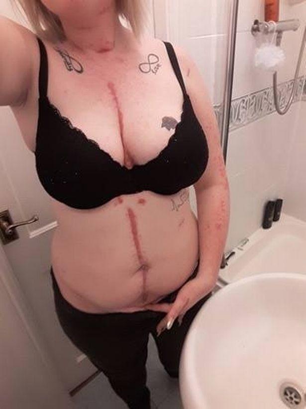 Млада жена получи 17 удара с нож по време на секс игра "50 нюанса сиво" (СНИМКИ 18+)