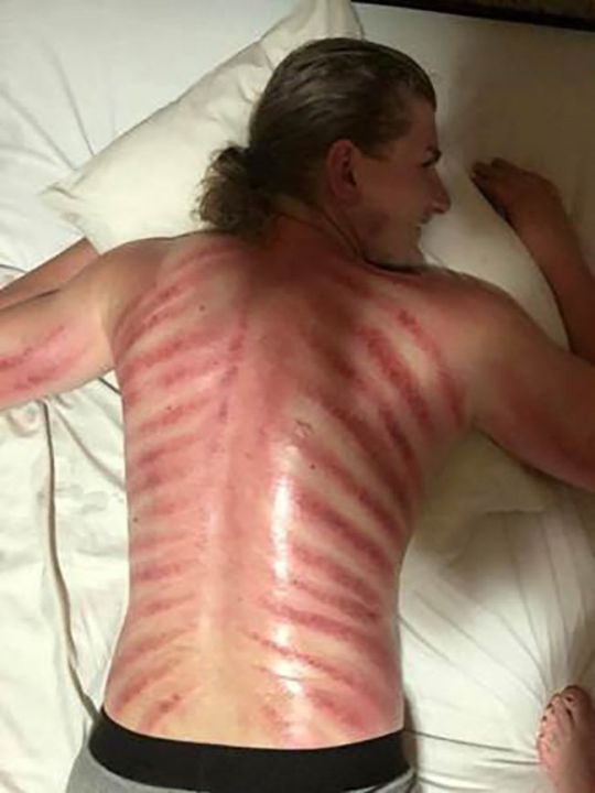Турист реши да си направи масажа на "червения дракон", но после съжали жестоко (СНИМКИ)