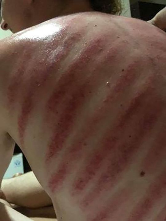 Турист реши да си направи масажа на "червения дракон", но после съжали жестоко (СНИМКИ)