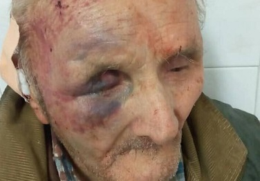 Само в БЛИЦ! Кикбоксьор изригна: Циганин преби брутално дядо ми в Славяново! 120 лева спасили живота на пенсионера (СНИМКИ 18+)