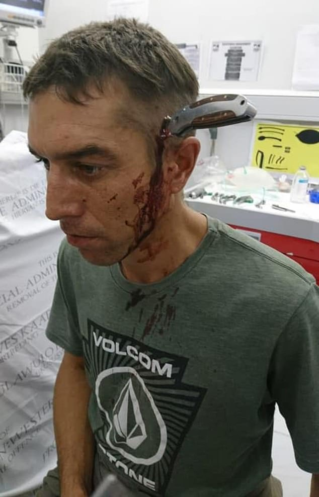 Имате ли свободен лекар: Мъж със забит в главата нож спокойно помоли за помощ (СНИМКИ 18+)