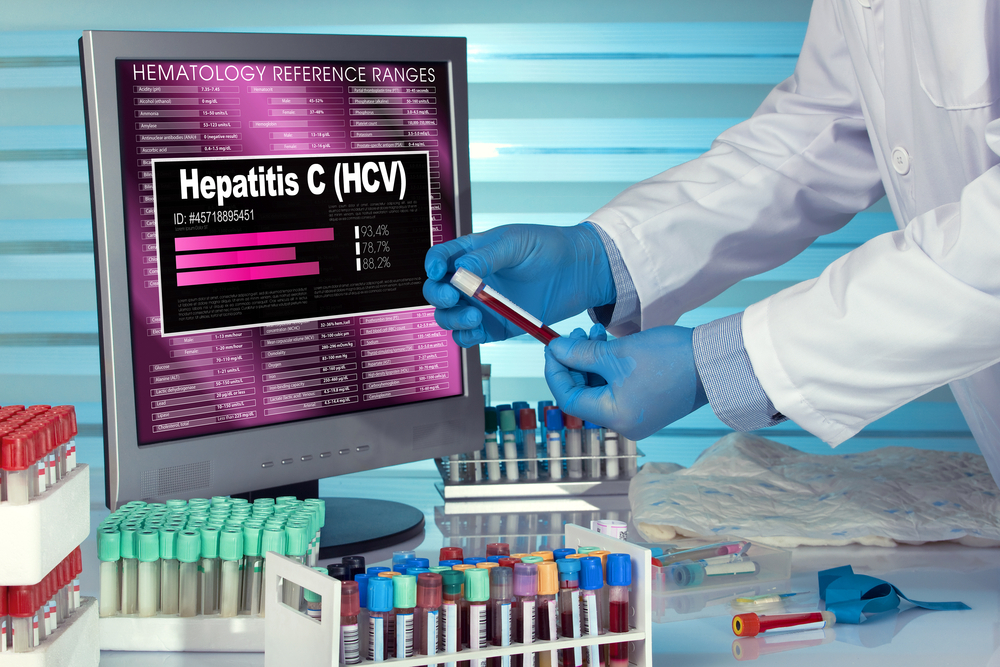 Откриха 30 нови случая на хепатит В и С само за три месеца, а заразените с ХИВ са…