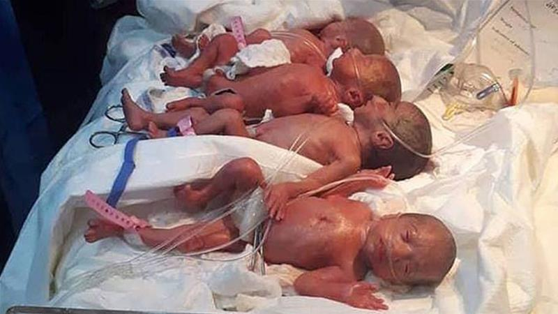 Жена роди седем бебета наведнъж! (СНИМКА)