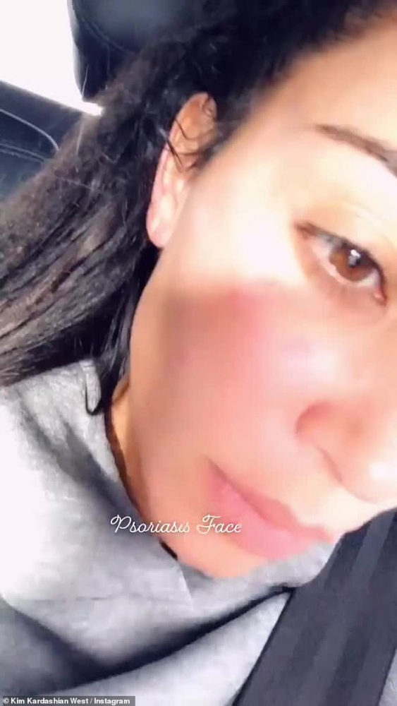 Ким Кардашиян се показа без грим! Болестта направо е съсипала лицето й! (СНИМКИ/ВИДЕО) 