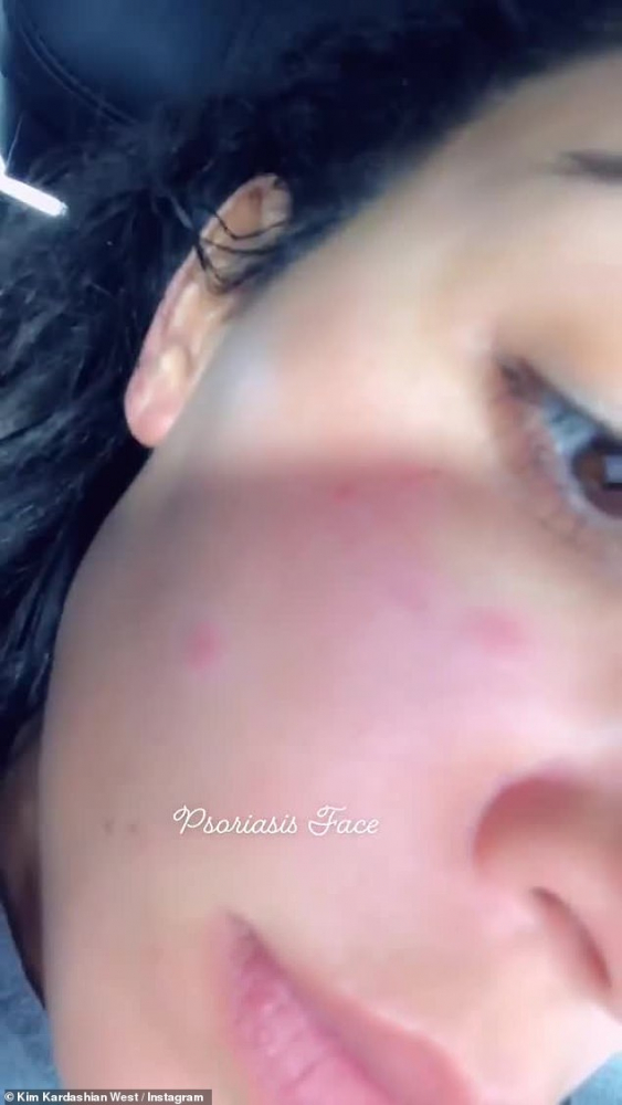 Ким Кардашиян се показа без грим! Болестта направо е съсипала лицето й! (СНИМКИ/ВИДЕО) 