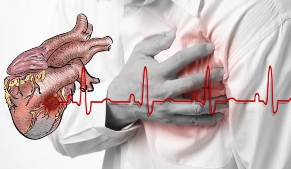 Кардиолози бият тревога: Бум на инфарктите на 3 април!