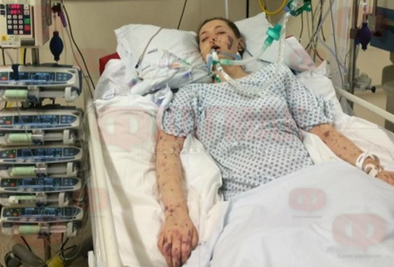 Страшна трагедия! 36-годишна жена почина след менингит в Бургас