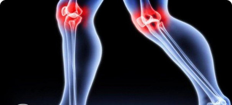 8 упражнения при болки в коленете препоръча именит физиотерапевт