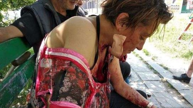 Невиждано зверство в София! Бездомна жена стои цялата в кръв след жесток побой (СНИМКА 18+)