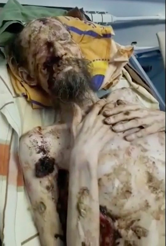 Изненадващи 11-годишни СНИМКИ на "живата мумия", която уж бе ръфана от мечка
