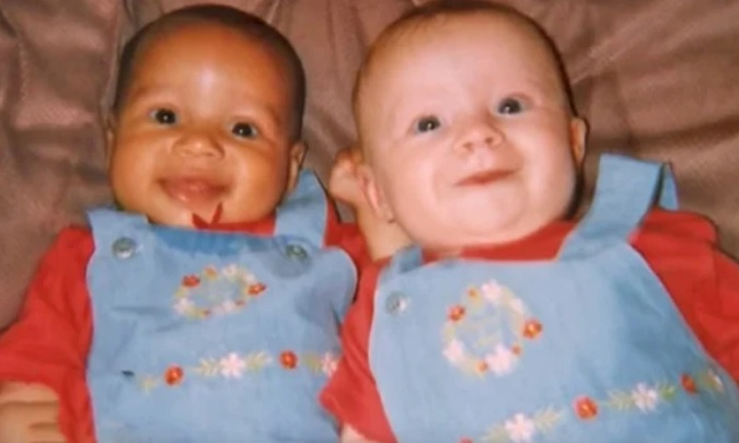 Помните ли близначките с бял и тъмен цвят на кожата? 20 години по-късно те... (СНИМКИ)