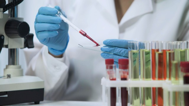 Американска компания почва изпитание на ваксина срещу вируса ХИВ