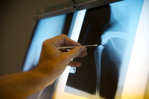 Доказаха: Рентгенът предизвиква рак 