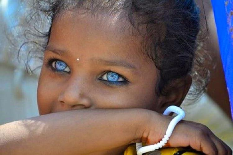 Рядко чудо на природата: Как изглеждат тъмнокожите деца, родени със сини очи СНИМКИ